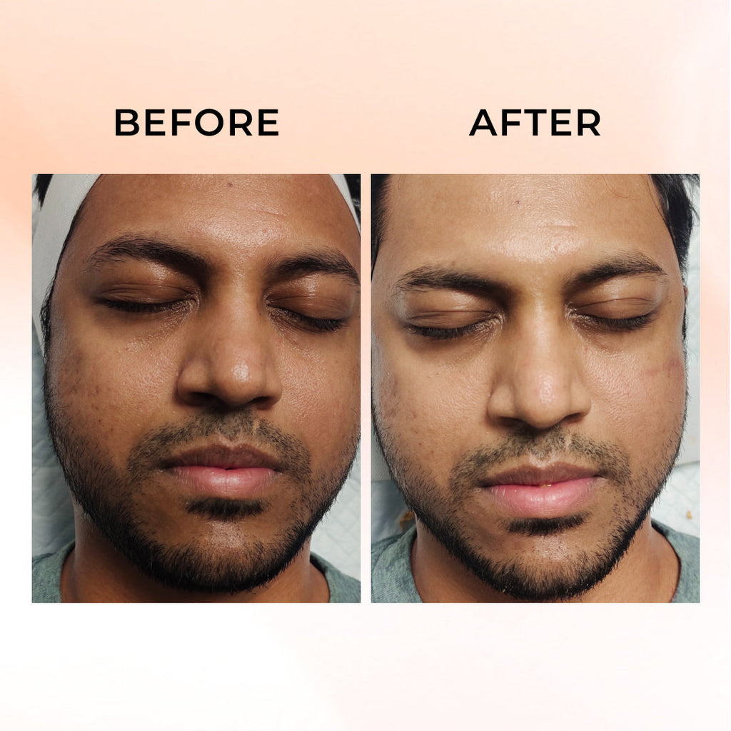 Magic Face & Body Wash Gel